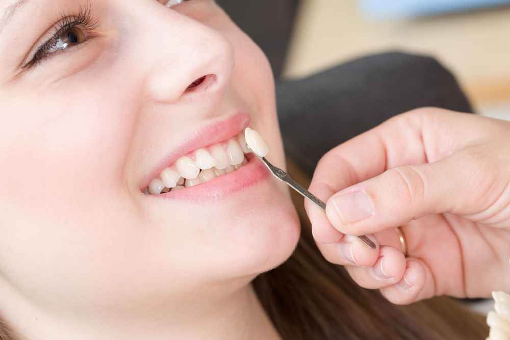 Reasons You Should Consider Getting Dental Veneers