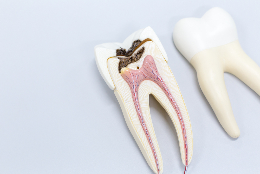 Root Canal Recovery: Tips for a Smooth Healing Process