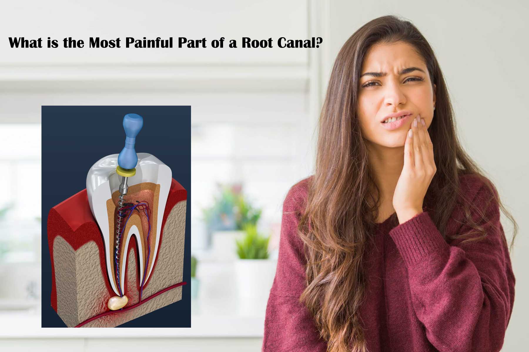 What is the Most Painful Part of a Root Canal?